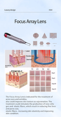 ทั้งหมดในหนึ่ง Picosecond Laser Hair Removal และ ND YAG Laser เครื่องกําจัดรอยสัก
