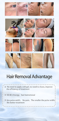 ทั้งหมดในหนึ่ง Picosecond Laser Hair Removal และ ND YAG Laser เครื่องกําจัดรอยสัก
