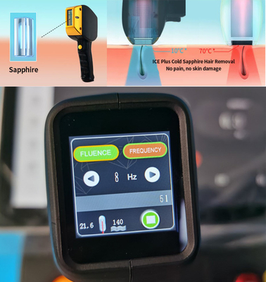 XL Ice Titanium 808 810nm Diode Trio Laser Hair Removal Q Switch ND YAG การกําจัดรอยสักด้วยเลเซอร์