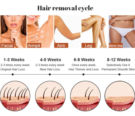ร้านเสริมความงาม IPL เครื่องเลเซอร์กําจัดผม RF การดูแลผิวหนัง การกําจัดรอยสัก