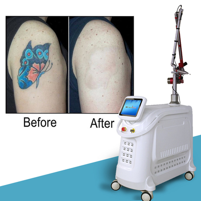 1064nm Q Switched Nd Yag Laser Picosecond เครื่องกําจัดรอยสัก