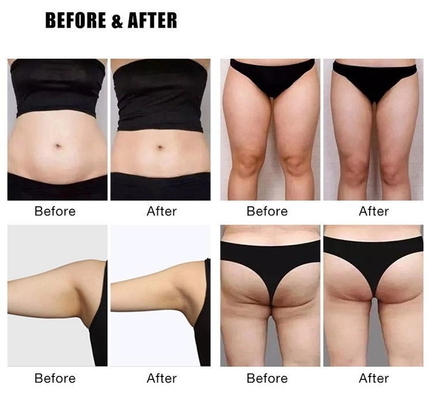 เครื่องลดน้ําหนัก EMS Slim เครื่องลดน้ําหนัก 4000W เครื่องปั้น EMS