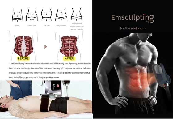 เครื่องลดน้ําหนัก EMS ที่ทันสมัย ความถี่ 150HZ สําหรับการลดเซลลูไลท์