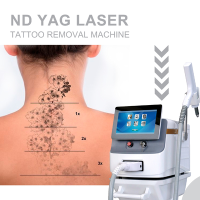 เครื่องกําจัดผมเลเซอร์ Nd YAG จังหวะยาว