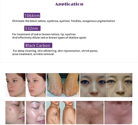 เครื่องกําจัดผมเลเซอร์ OPT IPL RF ND YAG มีหลายฟังก์ชัน พร้อมจอสัมผัส 15 นิ้ว