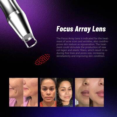3000W 350PS Picosecond Pico Way Laser Pigment Removal Nd Yag Laser Picosecond Tatoo Removal เครื่องเลเซอร์ถอดเครื่อง EU Plug